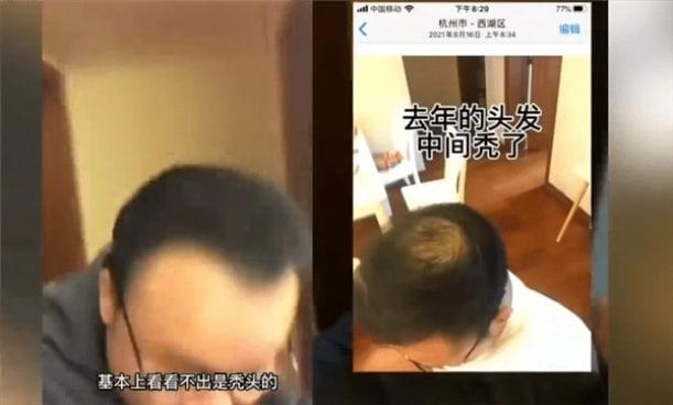 男子回應“不用洗發(fā)水變滿頭黑發(fā)”