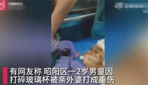 2歲男童因打碎玻璃杯遭外婆暴力毆打，生命岌岌可危