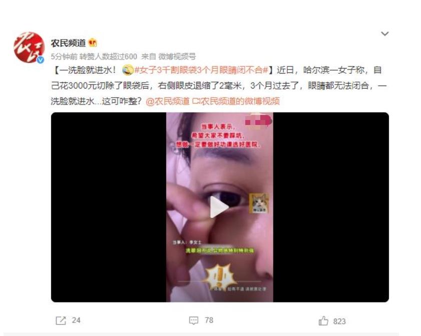 眼袋手術(shù)后3個月眼睛閉不合，女子苦惱洗臉進(jìn)水該如何解決？